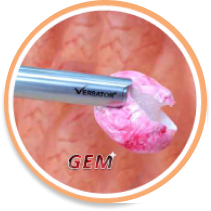 GEM™ Technology