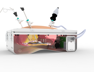 Bead Placement Soft Tissue Model